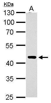 ERCC8 Rabbit Polyclonal Antibody