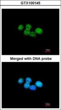ERCC8 antibody [N2C2], Internal