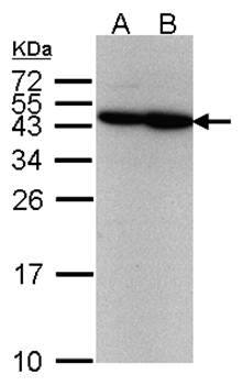 ERCC8(CSA) antibody