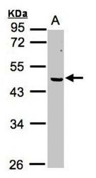 ERCC8(CSA) antibody