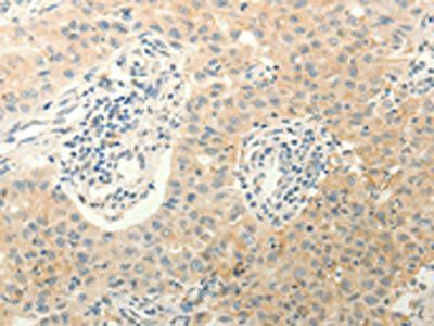 ERG Antibody