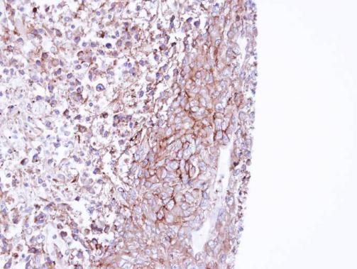MPP1 antibody [N1C1]