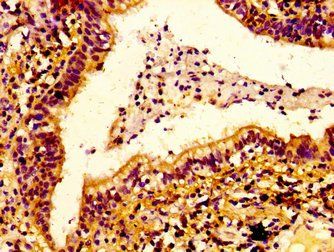 ERGIC2 Antibody