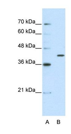 ERI1 antibody