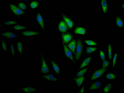 MAPK1 Recombinant Monoclonal Antibody
