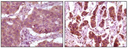 ERK2 Antibody