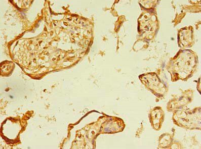 ERLIN1 Antibody