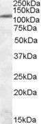 Goat anti-ERN1 / IRE1a Antibody