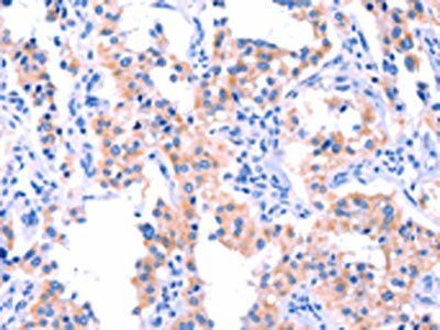 ERN2 Antibody