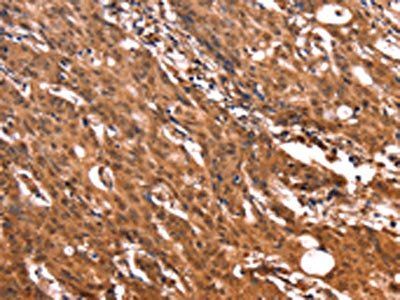 ERN2 Antibody