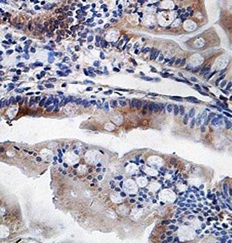 ERO1L Rabbit Polyclonal Antibody