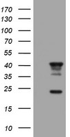 ERp72 (PDIA4) antibody