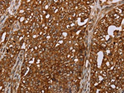 ERRFI1 Antibody