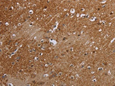 ERRFI1 Antibody