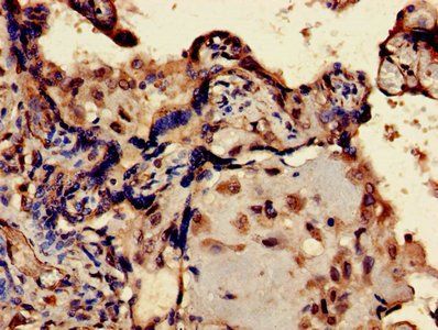 ERVK-6 Antibody