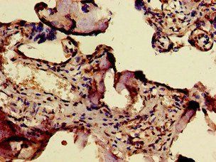 ERVW-1 antibody