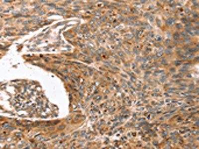 ERVW-1 Antibody