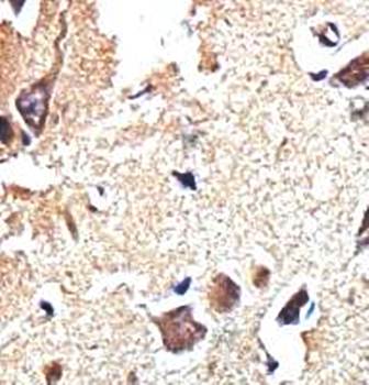 ESD antibody