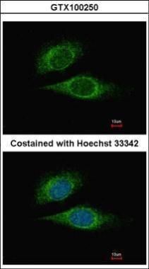 ESE1 antibody