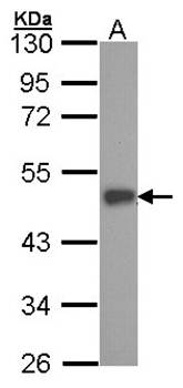 ESE1 antibody