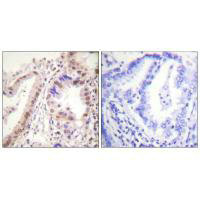 ESR1 (Ab-537) Antibody