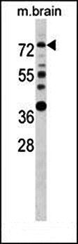 ESR1 antibody