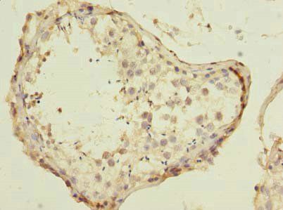 ESRG Antibody