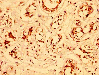 ESRP2 Antibody