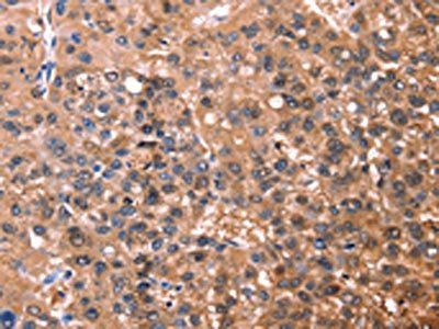 ESRRB Antibody
