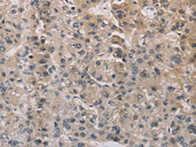 ESRRG Antibody