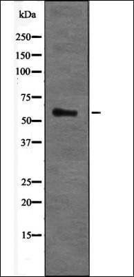 Estrogen Receptor beta (Phospho-Ser87) antibody