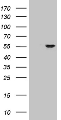 Estrogen Related Receptor alpha (ESRRA) antibody