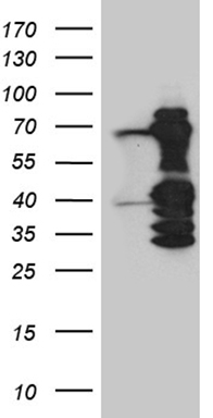 Estrogen Related Receptor alpha (ESRRA) antibody
