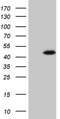 Estrogen Related Receptor beta (ESRRB) antibody