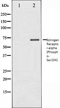 Estrogen Receptor-alpha (Phospho-Ser104) antibody