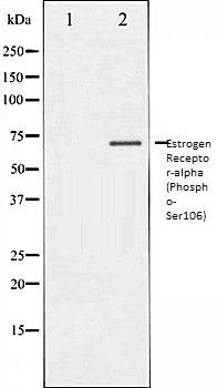 Estrogen Receptor-alpha (Phospho-Ser106) antibody