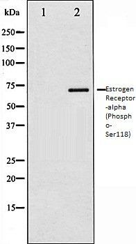 Estrogen Receptor-alpha (Phospho-Ser118) antibody