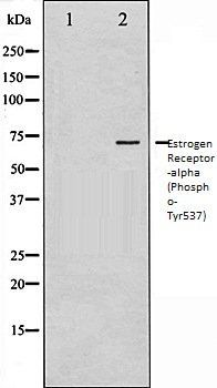Estrogen Receptor-alpha (Phospho-Tyr537) antibody