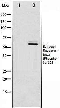 Estrogen Receptor beta antibody