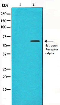 Estrogen Receptor-alpha antibody