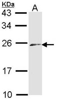 ET-3 antibody