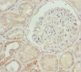 ETFA Antibody