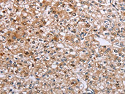 ETFB Antibody
