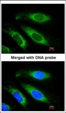 ETFB Rabbit Polyclonal Antibody