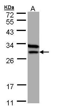 ETFB Rabbit Polyclonal Antibody