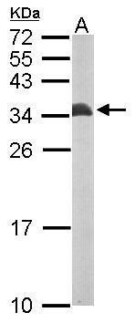 ETFB Rabbit Polyclonal Antibody