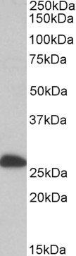 Goat anti-ETFB / FP585 (aa 152-165) Antibody