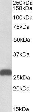 Goat anti-ETFB (aa 231-243) Antibody