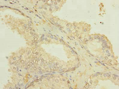 ETFDH Antibody