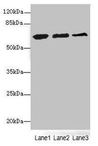 ETFDH Antibody